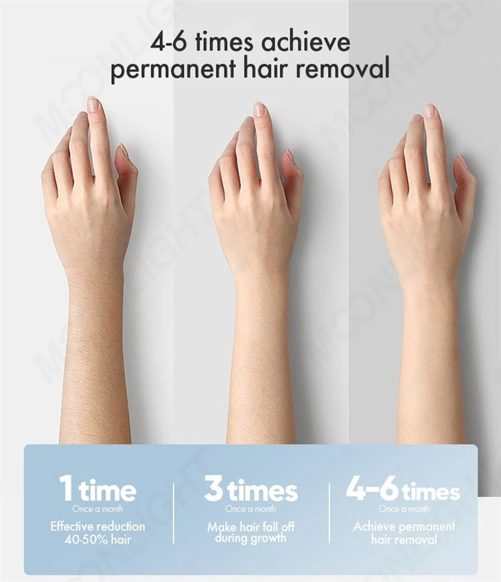 Artificial Intelligence System Laser Hair Removal Machine