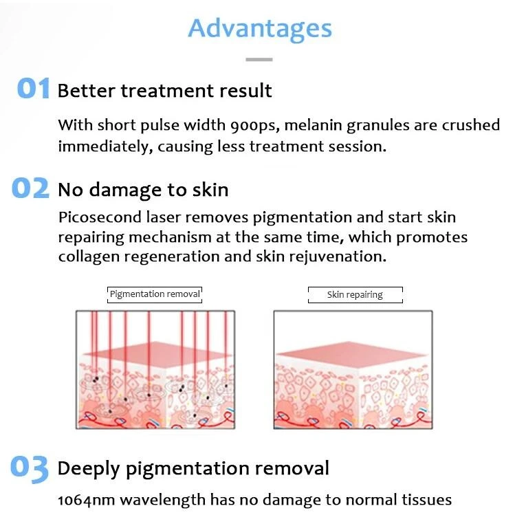 Best Picosecond Laser Machine